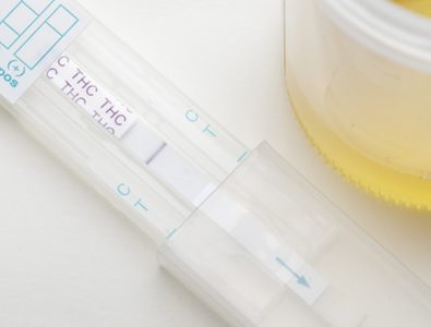Urine Drug Test