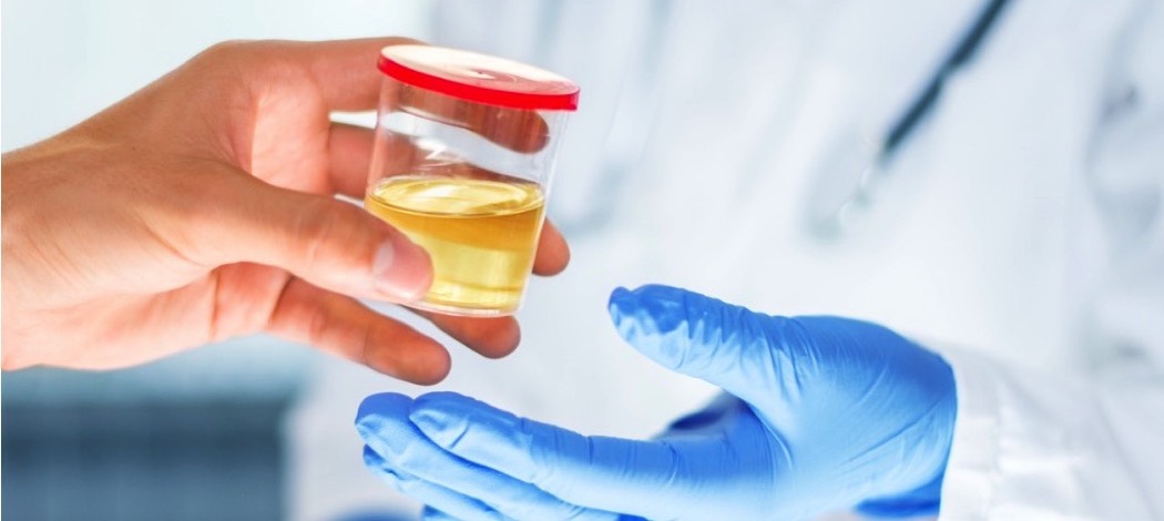 Urine Drug Test