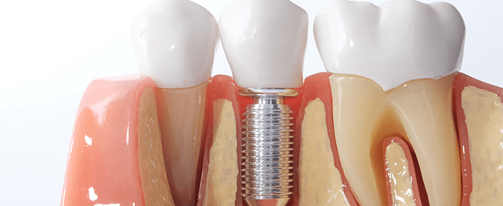 How To Select The Appropriate Dentist For Your Surgery