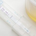 Urine Drug Test
