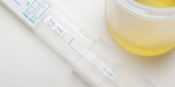 Urine Drug Test