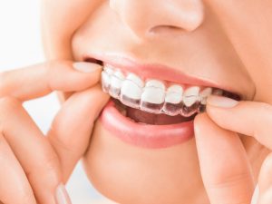 What are the several reasons for teeth discoloration?